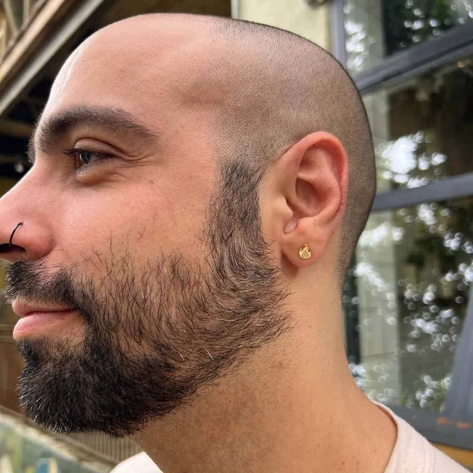 Aretes On Fire — vista 3
